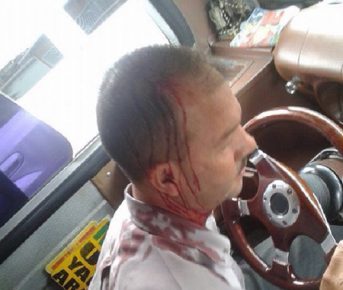 El chofer fue herido en la cabeza presuntamente por militantes chavistas